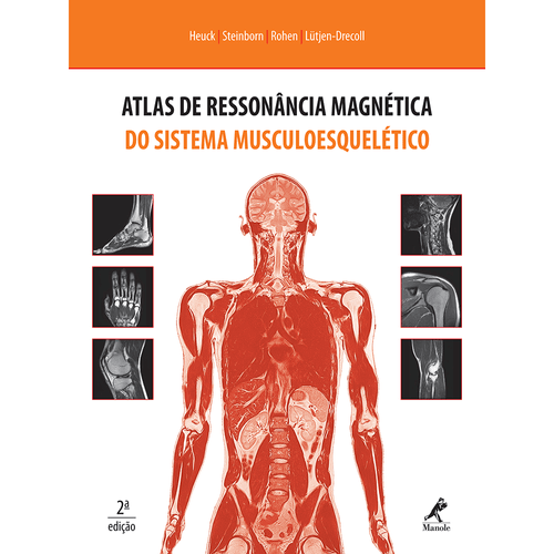 Atlas de ressonância magnética do sistema musculoesquelético – 2ª EDIÇÃO