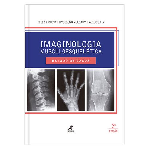 Imaginologia musculoesquelética: Estudo de casos – 3ª EDIÇÃO