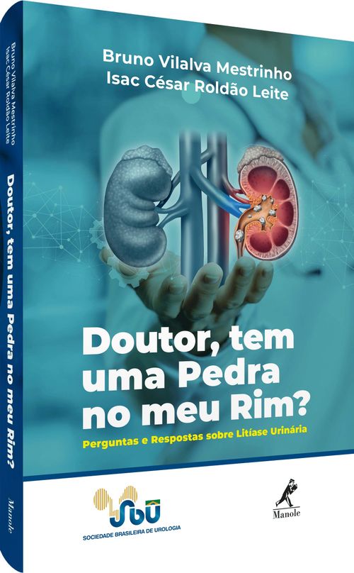 Doutor, tem uma pedra no meu rim? - Perguntas e respostas sobre litíase urinária