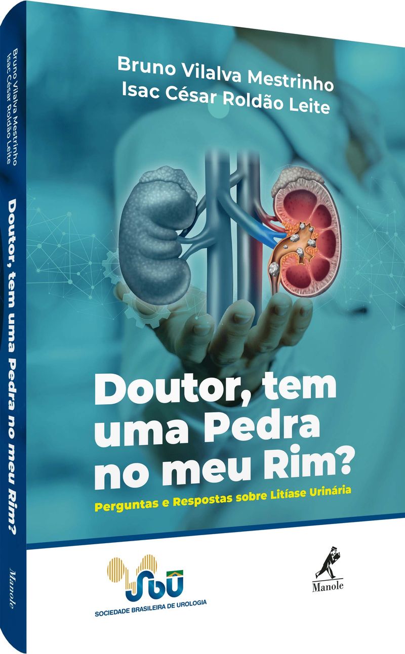 doutor-tem-uma-pedra-no-meu-rim-perguntas-e-respostas-sobre-litiase-urinaria