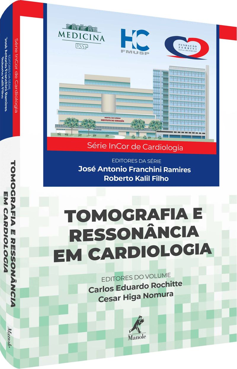 tomografia-e-ressonancia-em-cardiologia