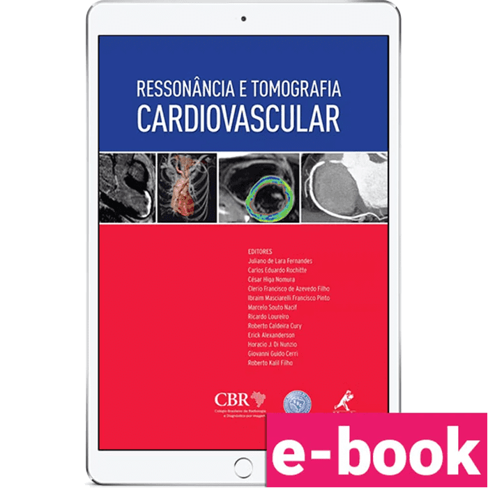 ressonancia-e-tomografia-cardiovascular-1º-edicao