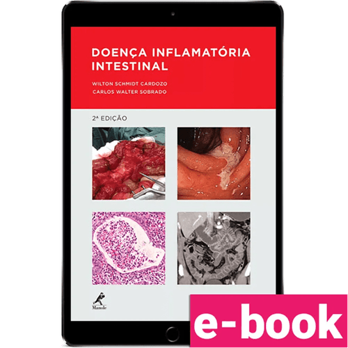 Doença Inflamatória Intestinal – 2ª Edição
