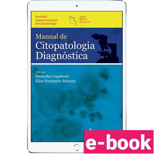 Manual de Citopatologia Diagnóstica: Sociedad Latinoamericana de Citopatologia (Português) – 1ª Edição - Ebook