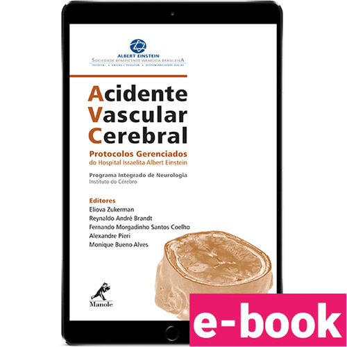 AVC Acidente Vascular Cerebral: Protocolos Gerenciados do Hospital Israelita Albert Einstein – 1ª Edição - Ebook