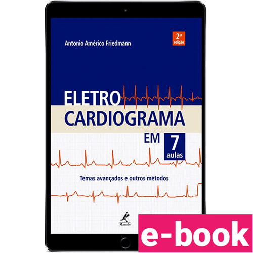 Eletrocardiograma em 7 Aulas: temas avançados e outros métodos - 2ª Edição - Ebook