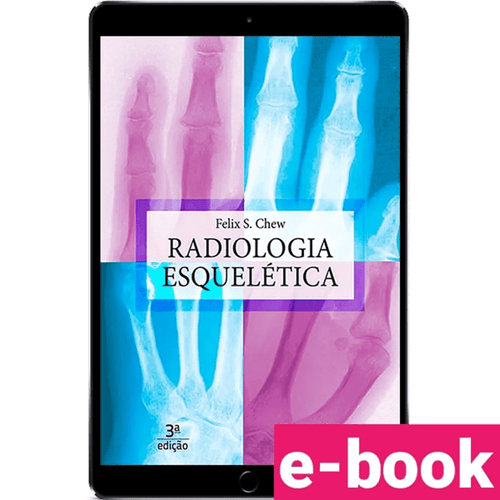 Radiologia esquelética – 3ª Edição - Ebook