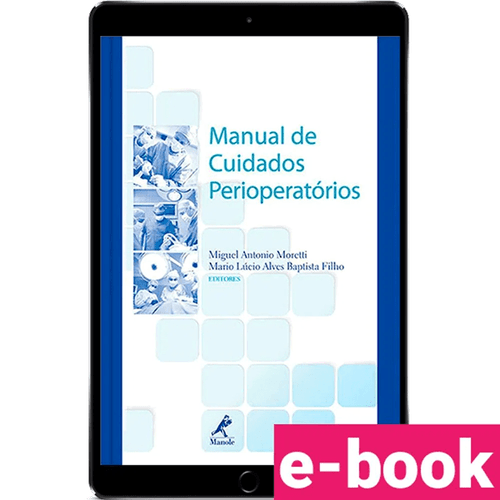 Manual de cuidados perioperatórios – 1ª Edição - Ebook