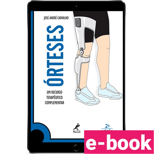 Órteses: um recurso terapêutico complementar – 2ª Edição - Ebook