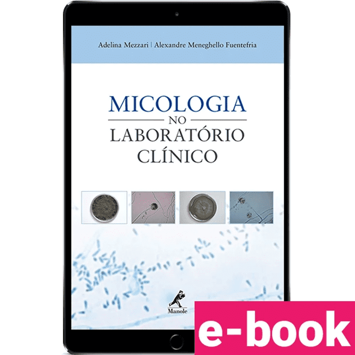 micologia-no-laboratorio-clinico-1º-edicao_optimized