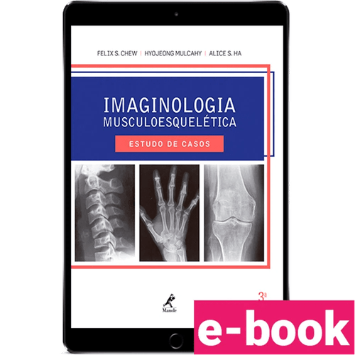 Imaginologia musculoesquelética: Estudo de casos – 3ª Edição - Ebook