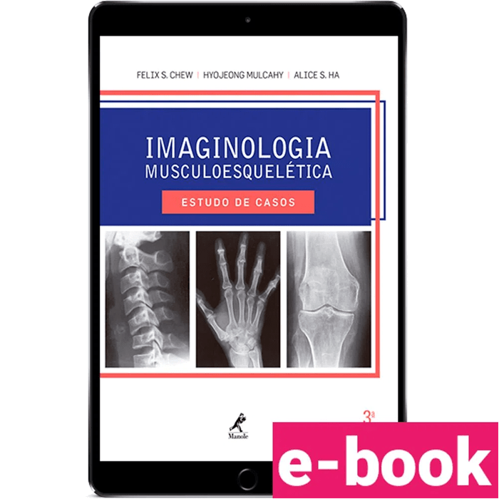 Imaginologia-musculoesqueletica-estudo-de-casos-3º-edicao-min.png