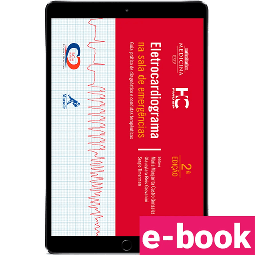 Eletrocardiograma na sala de emergências: Guia prático de diagnóstico e condutas terapêuticas – 2ª Edição - Ebook