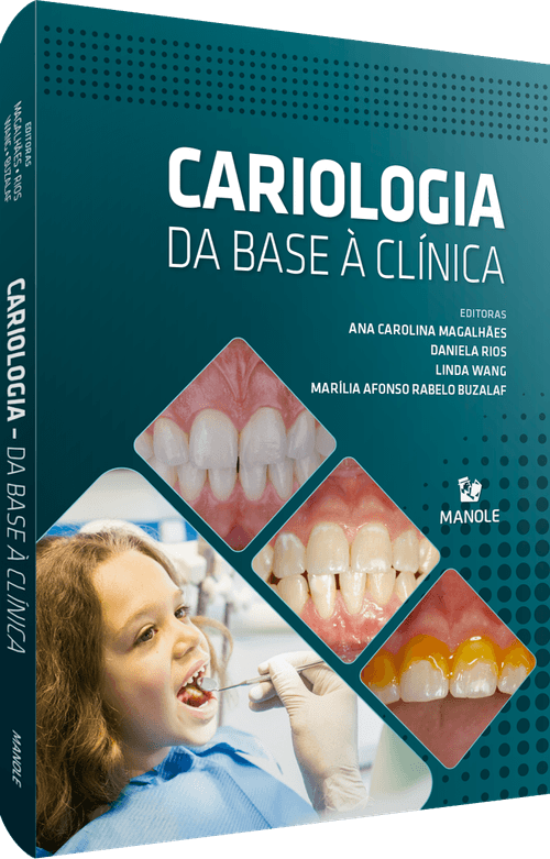 Cariologia: Da base à clínica 1ª Edição