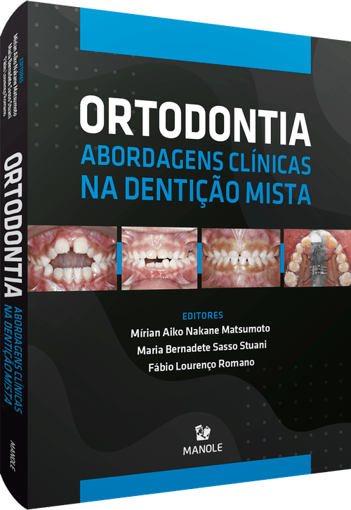 Ortodontia: Abordagens clínicas na dentição mista 1ª Edição