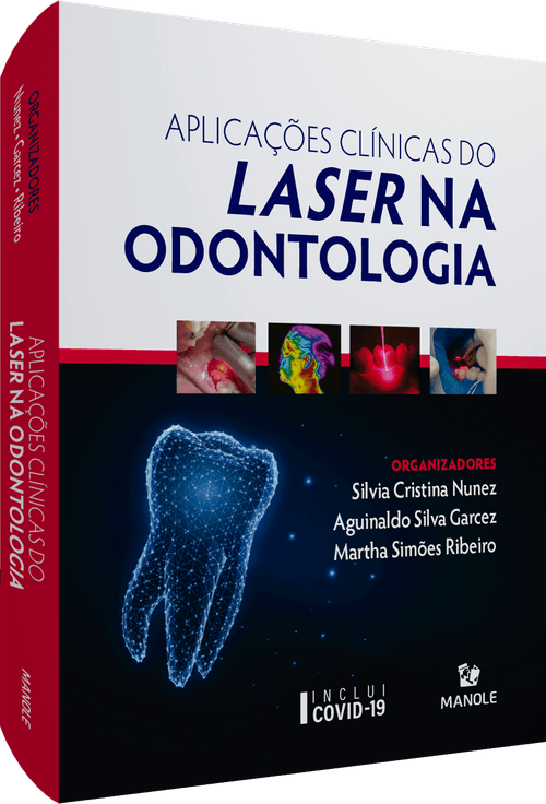 Aplicações clínicas do laser na odontologia