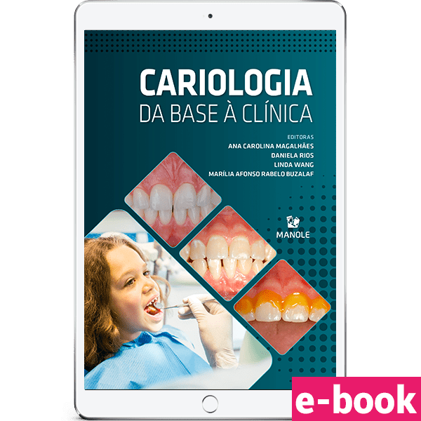 cariologia-da-base-a-clinica-min