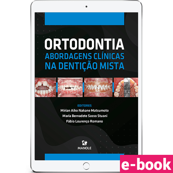 ortodontia-abordagens-clinicas-na-denticao-mista-1-edicao-min