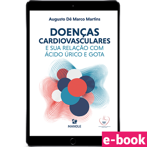 Doenças cardiovasculares e sua relação com ácido úrico e gota 1ª Edição - Ebook