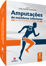 Amputacoes-de-Membros-Inferiores--1-