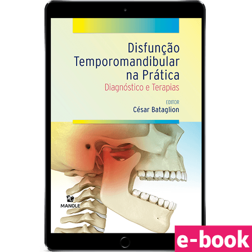 Disfunção Temporomandibular na Prática - Diagnóstico e terapias - Ebook