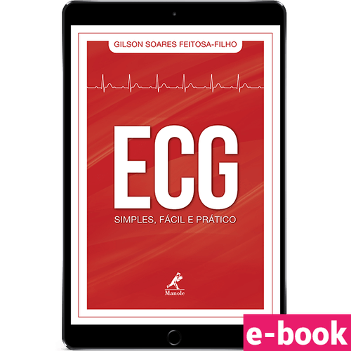 ECG Simples, Fácil e Prático 1ª Edição - Ebook