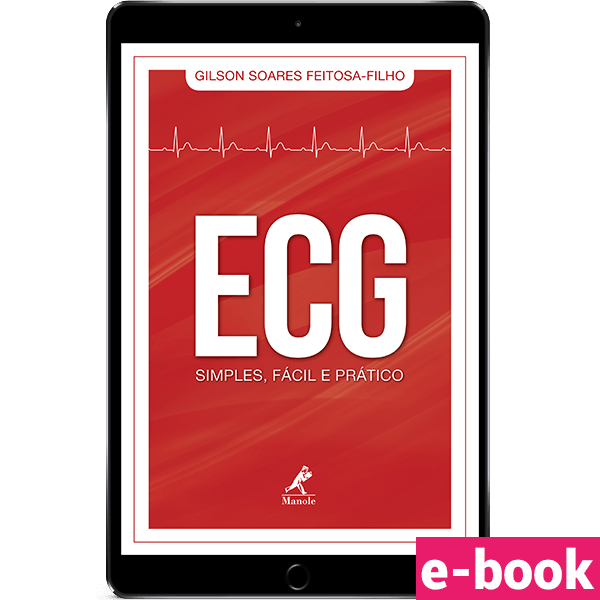 ECG-SIMPLES-FACIL-E-PRATICO