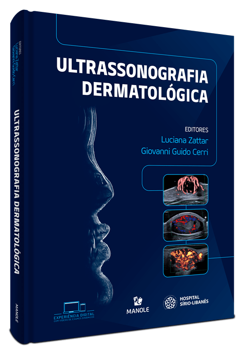 Ultrassonografia dermatológica 1ª Edição