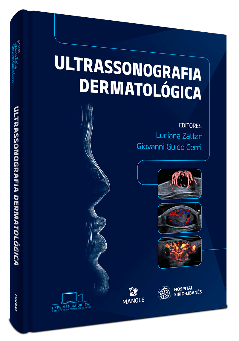 Ultrassonografia_Dermatologica