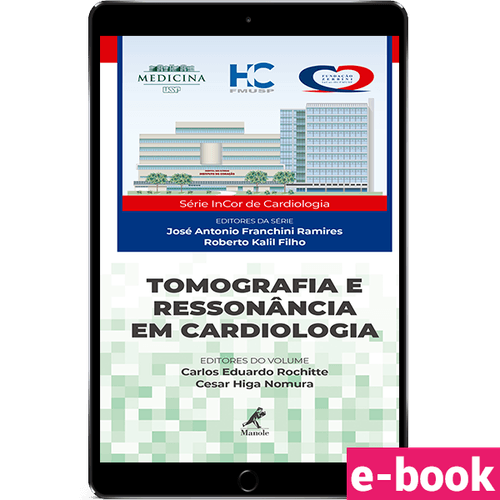 Tomografia e ressonância em cardiologia - Ebook