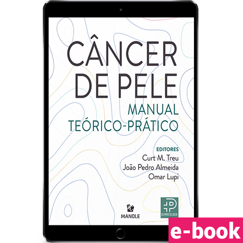 Câncer de pele: Manual teórico-prático 1ª Edição - Ebook