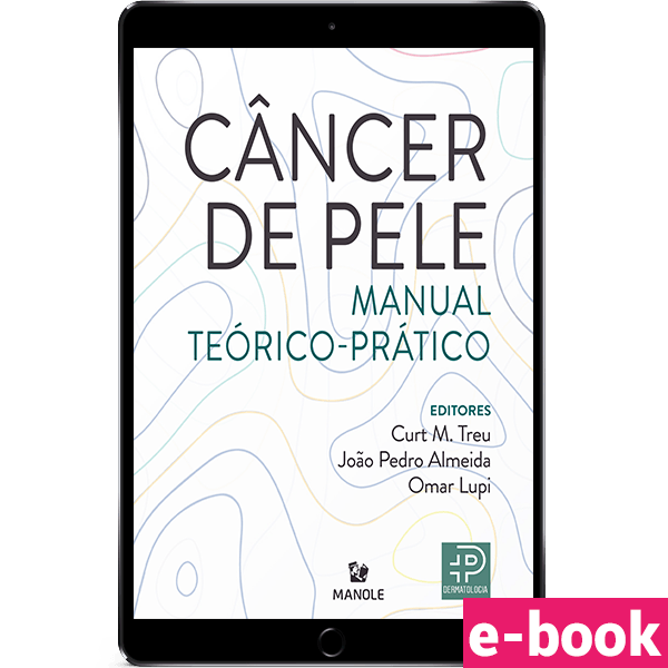 Cancer-de-Pele