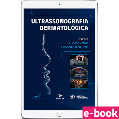 Ultrassonografia dermatológica 1ª Edição