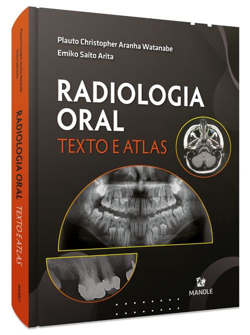 Radiologia Oral - Texto e Atlas 1ª Edição