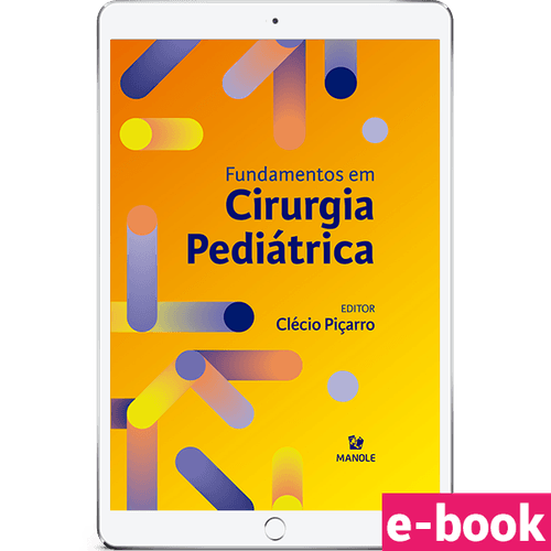 Fundamentos em Cirurgia Pediátrica 1ª Edição - Ebook