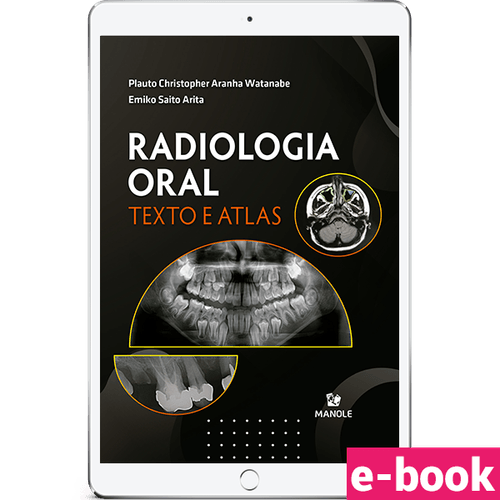 Radiologia Oral - Texto e Atlas 1ª Edição - Ebook