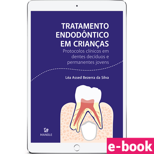 Tratamento Endodôntico em Crianças - 1ª Edição Protocolos clínicos em dentes decíduos e permanentes jovens - Ebook