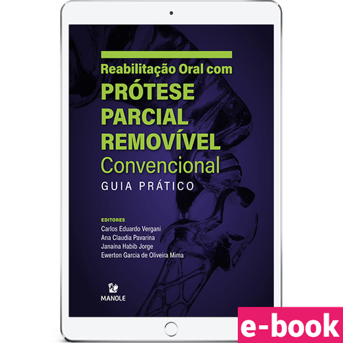 Reabilitação Oral com Prótese Parcial Removível Convencional - Guia Prático - 1ª Edição - Ebook