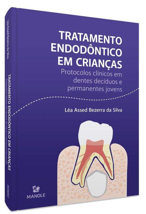 Tratamento Endodôntico em Crianças - 1ª Edição Protocolos clínicos em dentes decíduos e permanentes jovens