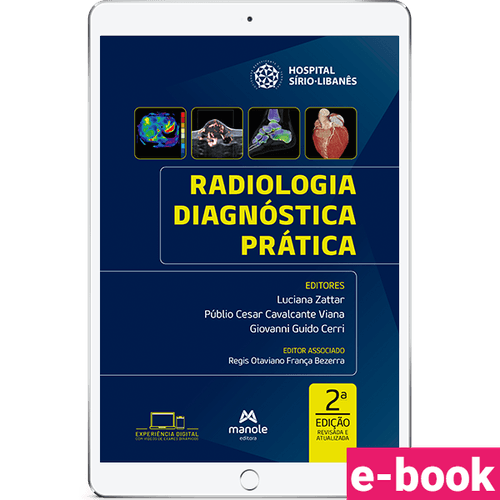 Radiologia Diagnóstica Prática Manual da Residência do Hospital Sírio-Libanês 2ª edição - Ebook