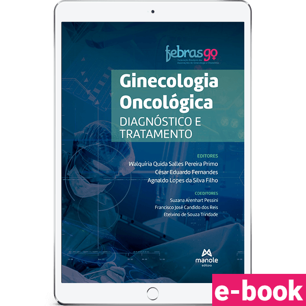 Ginecologia-Oncologica---Diagnostico-e-Tratamento