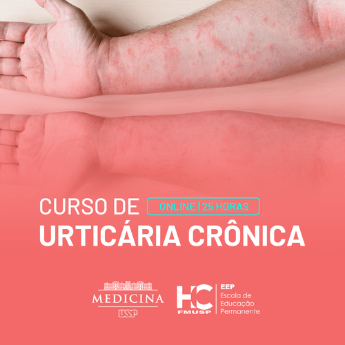 Urticária Crônica