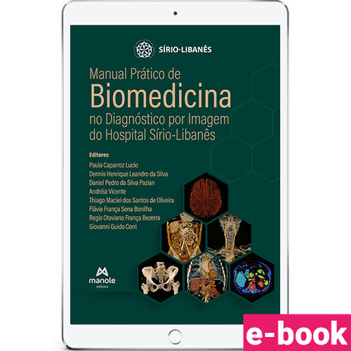 Manual Prático de Biomedicina no Diagnóstico por Imagem do Hospital Sírio-Libanês - 1ª Edição