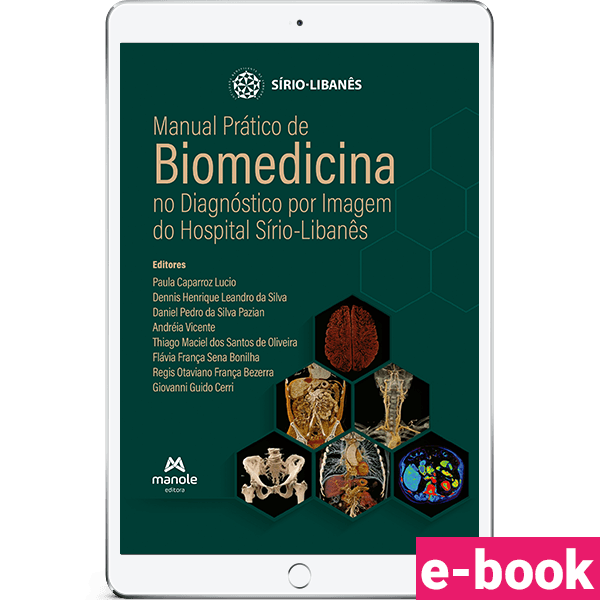 Emanuelle Brancalhão - Biomedica imagenologista - Unitom Unidade