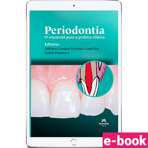 Periodontia - 1ª Edição O essencial para a prática clínica - Ebook