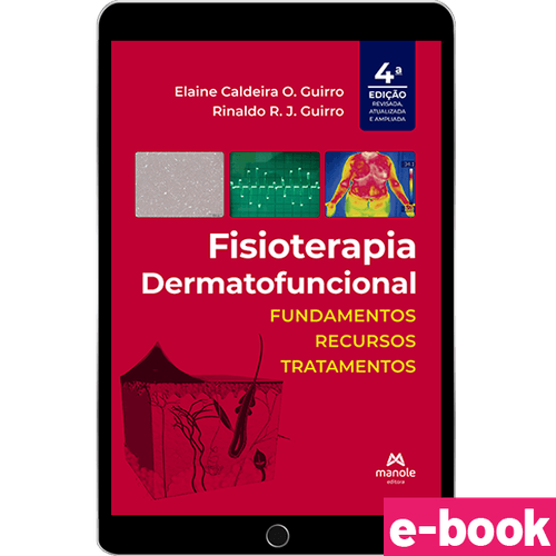 Fisioterapia dermatofuncional - 4ª Edição Fundamentos, recursos e tratamentos - Ebook