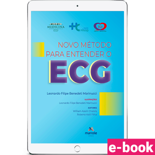 Novo método para entender o ECG - 1ª Edição - Ebook