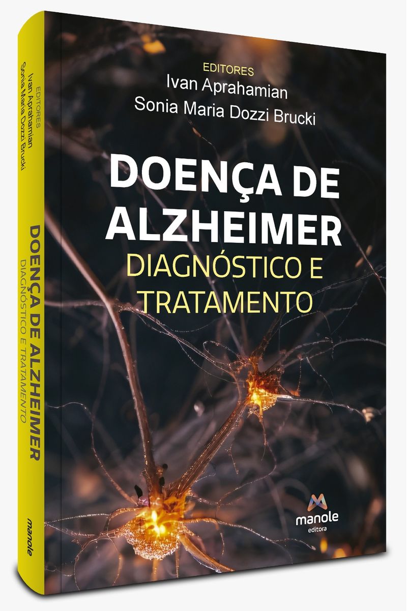 doenca-de-alzheimer-1-edicao-diagnostico-e-tratamento