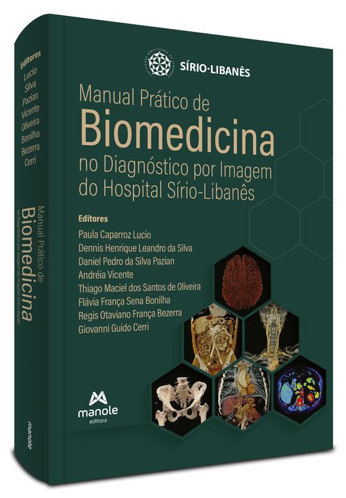 Manual Prático de Biomedicina no Diagnóstico por Imagem do Hospital Sírio-Libanês - 1ª Edição
