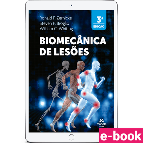 Biomecânica de Lesões - 3ª Edição - Ebook